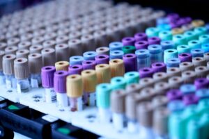 理系転職に転職エージェント・転職サイトは使える？理系の確実な転職成功法